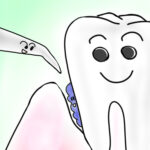 歯医者 歯石の掃除